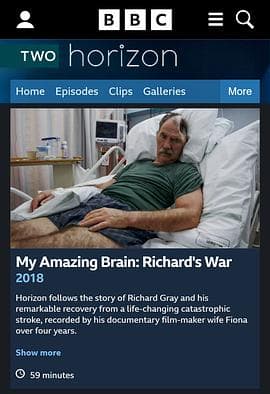 地平线系列：我的神奇大脑 - 纪录片 (2018) 海报