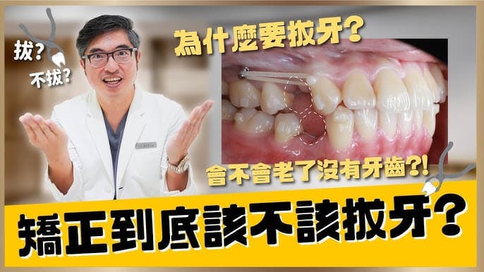 牙齿矫正到底需不需要拔智齿?牙齿矫正拔牙与不拔牙到底有什么优缺点? - 科普学习 (2025) 海报
